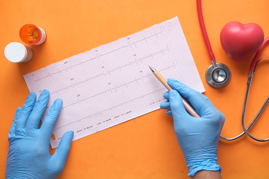 What Triggers AFib Episodes, and Do I Need to Avoid Coffee, Exercise, or Food?